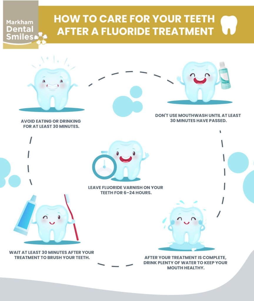 How Long To Wait To Eat After Fluoride: A Quick Guide